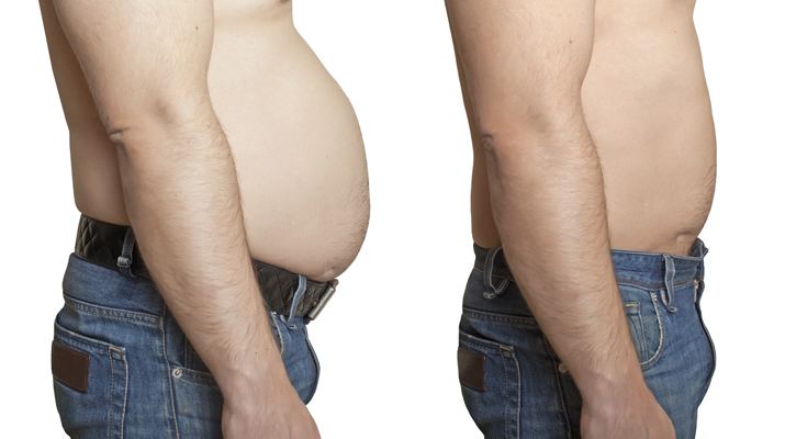 Chiropractic-Raleigh-NC-Solutions4-Weight-Loss-Before-and-After Chiropractic Raleigh NC Solutions4 Weight Loss Before and After
